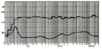 周波数特性図とインピーダンス特性図